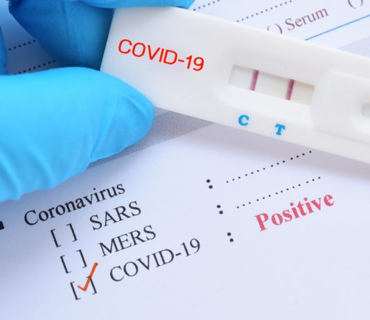 Des tests de dépistage rapides pour tout le monde